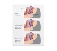 PIUHRKLEVD Health Education Poster Sleep Apnea Information Chart Educational Wall-Art for Classroom Clinic Study Office Decor(Framed,12x18inch(30x45cm))