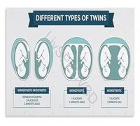 Placentation of Twins Detailed Anatomy Canvas Wall-Art Obstetrics Educational Chart for Hospital Clinic Home Office Decor(Unframed,16x24inch(40x60cm))