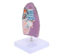 PLAFOPE Modèle de Poumon Fumeur Anatomique Pédagogique Modèle Pathologique Respiratoire Détaillé Matériel D’Enseignement Médical pour Physiologie et Anatomie Démonstration