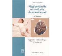 Plagiocéphalie Et Torticolis Du Nouveau-Né - Approche Ostéopathique Et Posturale