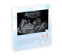 Plaque Souvenir commémorative en plexiglass pour Le deuil périnatal, Hommage funéraire Personnalisable pour Enfant décédé avec Photo et Texte, Fixation adhésive, 8x8 cm ou 12x12 cm