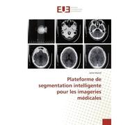 Plateforme de segmentation intelligente pour les imageries médicales - Jarrar Manel - Universitaires Europeennes - broché - Etude