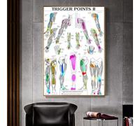 Points De Déclenchement, Partie 2, Diagramme Anatomique, Affiche D'Anatomie, Art Mural, Film, Décoration D'Intérieur, Peinture, 40 X 60 Cm, Sans Cadre