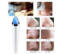 Points Noirs Électriques Acné Dissolvant Soins De La Peau Pores Vide Acné Bouton Outil D'aspiration Nettoyant Pour Le Visage Masseur Machine Visage Propre