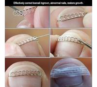 Pongnas Fil de Fixation incarné, Outil de Correction des Ongles en Acier Inoxydable pour Ongles Incarnés, Anormaux, avec 6 Tailles pour Soins de Pédicure