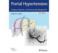 Portal Hypertension: Imaging, Diagnosis, and Endovascular Management