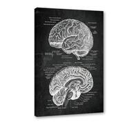 Poster anatomique de la neurologie du cerveau humain, art médical, impression anatomique, neurologue, psychiatre, médecin, décoration de bureau (SKU2, 30 x 45 cm), encadré (toile enroulée))