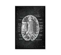 Poster anatomique de neurologie du cerveau humain, art médical, impression anatomique, neurologue, psychiatre, médecin, décoration de bureau (SKU20 x 30 cm), cadre en métal noir)