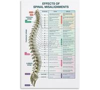 poster Human Spine Anatomy Art Print - Nervous System Diagram Educational Poster - Wall Decor for Chiropractor Office, Clinic & Study Room(Unframed,08x12inch(20x30cm))