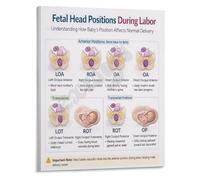poster Labor and Delivery Reference Poster Fetal Head Stations Guide Canvas Print for Hospital Maternity Ward Decor(Framed,08x12inch(20x30cm))