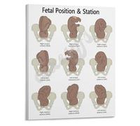 poster Labor and Delivery Wall-Art Fetal Station Diagram Birth Positions Poster Canvas Print for Maternity Ward(Framed,16x24inch(40x60cm))
