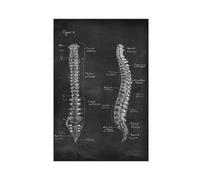 Poster sur toile représentant l'anatomie de la colonne vertébrale sur le chalkboar - Décoration de chambre à coucher - Paysage sportif - Décoration de bureau - Cadeau sans cadre : 30 x 45 cm