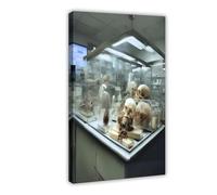 Poster sur toile représentant un crâne de laboratoire de pathologie - Décoration murale pour salon, chambre à coucher - 60 x 90 cm