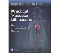 Practical Vascular Ultrasound Kenneth Myers Kenneth Myers - Amy May Clough (Auteur)