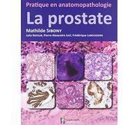 PRATIQUE EN ANATOMOPATHOLOGIE - LA PROSTATE