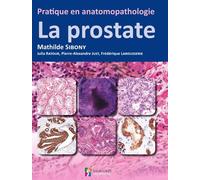 Pratique en anatomopathologie - la prostate - Sibony M - Sauramps Medical - broché - Etude