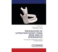 Preservation of Extraction Socket Using Bone Ring in Periodontics
