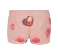 Pressure Ulcer Wound Model, Elderly Decubitus Sore Training Model, Multiple Simulated Ulcer Wounds, Pressure Sore Simulator Nursing Model Decubitus, for Medical Pratice(Silicone Material)