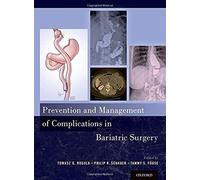 Prevention And Management Of Complications In Bariatric Surgery