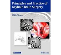 Principles And Practice Of Keyhole Brain Surgery