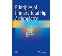 Principles of Primary Total Hip Arthroplasty