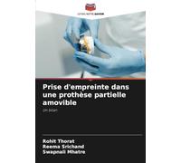 Prise d'empreinte dans une prothèse partielle amovible: Un bilan