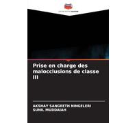 Prise en charge des malocclusions de classe III