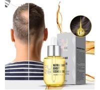 Produits pour la croissance des cheveux au gingembre, prévient la perte de cheveux, traitement du cuir chevelu à croissance rapide