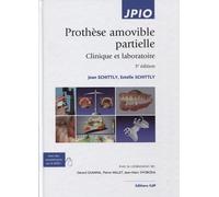 Prothèse Amovible Partielle - Clinique Et Laboratoire