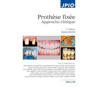 Prothèse fixée – Approche clinique – 2e éd.