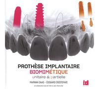 Prothèse Implantaire Biomimétique Unitaire Et Partielle