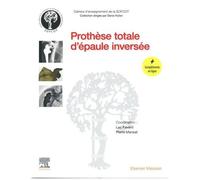 Prothèse Totale D'épaule Inversée