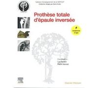 Prothèse totale d'épaule inversée Luc Favard (Auteur), Pierre Mansat (Auteur), SOFCOT (Auteur)