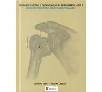 Protheses d'epaule, quoi de nouveau en traumatologie ? shoulder prosthesis, what Shoulder prosthesis, what's new in trauma ? - Laurent Obert - Sauramps Medical - broché - Scolaire / Universitaire