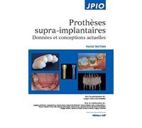 Prothèses supra-implantaires: Données et conceptions actuelles – CDP