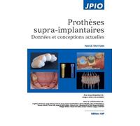Prothèses supra-implantaires Données et conceptions actuelles - Patrick Tavitian - Cdp - broché - Scolaire / Universitaire