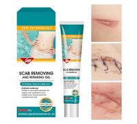 Pruojhw Gel Anti-Cicatrices | 20 g Gel Traitement Pour Blessures,Soin Long Terme pour les Cicatrices - Pour Confort Récupération Brûlure Protection Blessure Domestique Corps