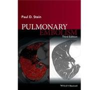 Pulmonary Embolism by Stein & Paul D. College of Osteopathic Medicine & Michigan State University & East Lansing & Michigan & USA Paul D Stein (Auteur)