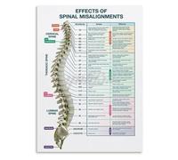QMIQXIWS Vertebral Subluxation and Spinal Nerve Function Chart, Educational Anatomy Canvas Wall-Art for Chiropractic Office Home Clinic Decor(Unframed,12x18inch(30x45cm))