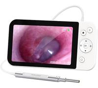 QOJJ Caméra Auriculaire Otoscope avec Écran, Caméra Otoscope Auriculaire Numérique avec Écran HD 1080P de 5 Pouces, Nettoyeur d'oreille 3,9 Mm pour Enfants et Adultes, Comprend Une Carte 32G FT