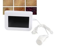 Qudinip Détecteur de Poils de Peau, Analyseur de Follicules Pileux de Cuir Chevelu avec Lentille 50X 200X pour la Détection de la Peau, Analyse des Cheveux, Salon de beauté, Salon de (Prise UE)