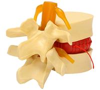 Qusedwey Modèle de vertèbres lombaires colonne vertébrale anatomique hernie discale lombaire outil d'enseignement de l'anatomie modèle de vertèbres lombaires