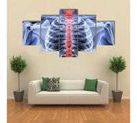 QYYAMDEQ Tableau Decoration Murale Avec Cadre 5 Panneau Tableau Mural Radiographie de la colonne vertébrale d'un homme 5 Pièces Tableaux, Posters Et Arts Décoratifs Tableau Moderne
