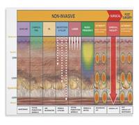 Radiance Scale Poster for Esthetician Office and Beauty Education Wall