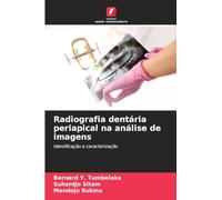 Radiografia dentária periapical na análise de imagens