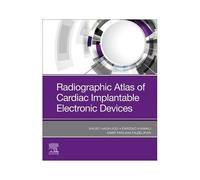 Radiographic Atlas Of Cardiac Implantable Electronic Devices