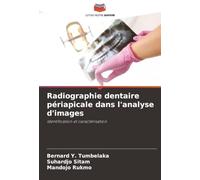 Radiographie dentaire périapicale dans l'analyse d'images: Identification et caractérisation