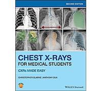 Radiographie du thorax pour les étudiants en médecine