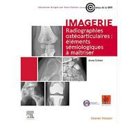 Radiographies ostéoarticulaires : éléments sémiologiques à maitriser