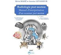 Radiologie post mortem Kevin Mahé (Auteur), Antoine Levasseur (Auteur), Pierrick Nègre (Auteur)